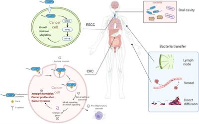 The bacteria inside human cancer cells: Mainly as cancer promoters